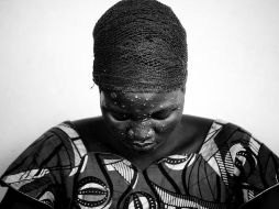 La mayoría de las personas se recuperan en varias semanas, la mortalidad sigue siendo baja. EL INFORMADOR/ Archivo