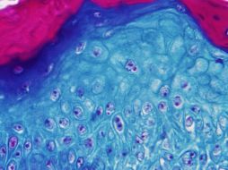 El estudio permitirá tener un panorama más amplio de cómo funciona la enfermedad. EFE/Centro de Control y Prevención de Enfermedades