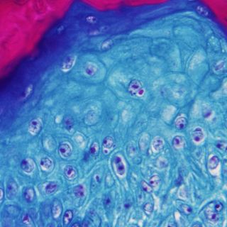 Antivirales podrían reducir los síntomas de la viruela del mono, así como su tiempo de contagio