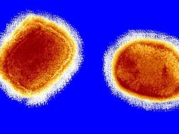 Por prevención se tomará en cuenta si la persona tiene antecedente de haber viajado a un país con brote registrado de la viruela de mono. EL INFORMADOR/ Archivo