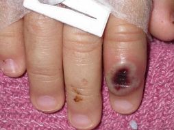 López-Gatell recuerda: 