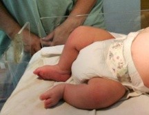 Autoridades reiteraron que ambos casos están pendientes de confirmación de que sea hepatitis infantil. NTX / ARCHIVO