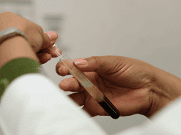 La prevención del cáncer de próstata puede ser oportuna gracias a un tamizaje que tiene pocos minutos de duración. SUN / ARCHIVO