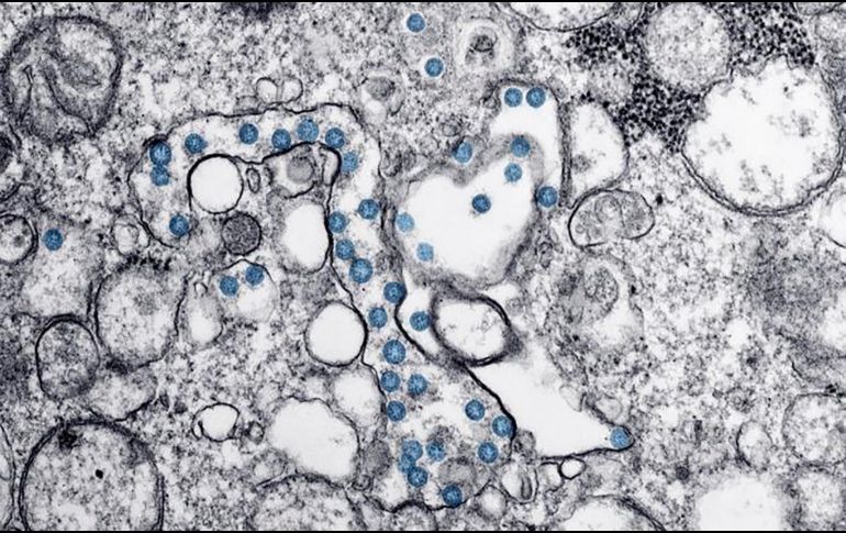 Científicos indican que no hay datos nuevos para evaluar la posibilidad de que el COVID haya salido de un laboratorio. AFP / ARCHIVO