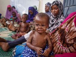Decenas de niños han fallecido por falta de agua y comida. AP