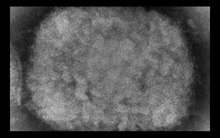 Imagen ilustrativa de un virus de viruela del mono, obtenido de una muestra asociada con el brote de perros de las praderas de 2003. AP/ARCHIVO