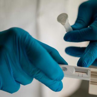 Reportan dos casos más de viruela del mono en Jalisco