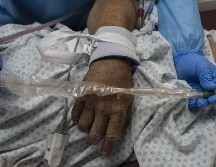 Las personas que fueron vacunadas contra la viruela humana están protegidas contra la viruela del mono. AFP / ARCHIVO