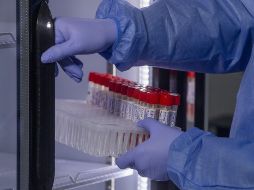 El mundo se ha mantenido alerta ante los casos crecientes de viruela del mono. EFE/ARCHIVO