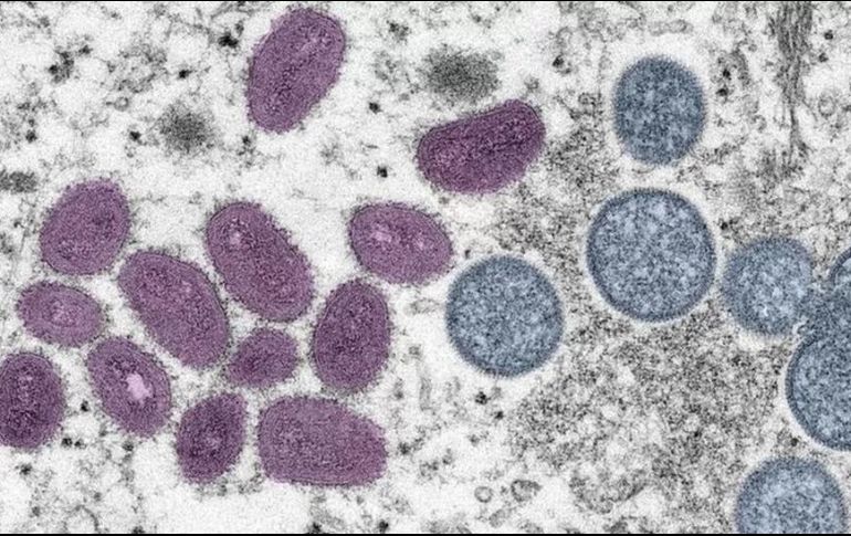 Este sábado fue declara emergencia mundial la viruela del mono. ESPECIAL