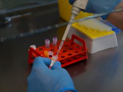 Los principales síntomas son fiebre, dolor de cabeza, fatiga y debilidad, dolores musculares, inflamación de los ganglios linfáticos, y erupciones cutáneas. EFE / ARCHIVO