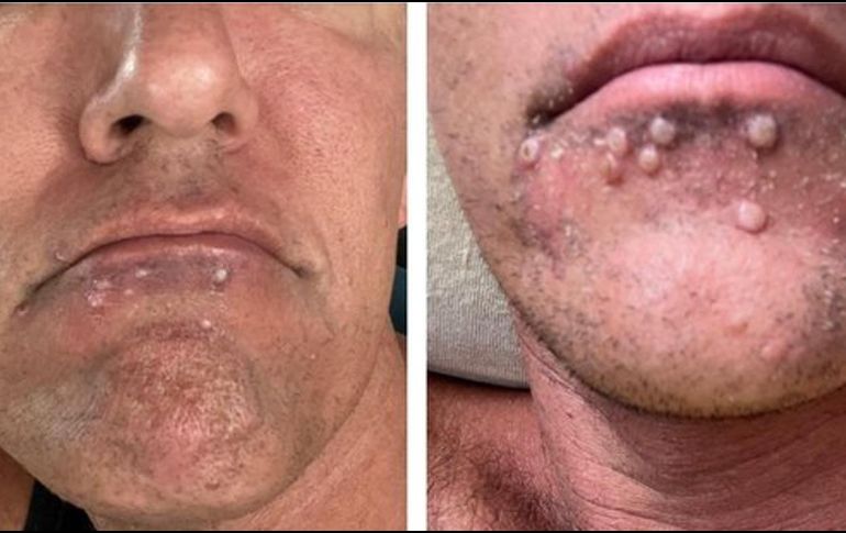 TWITTER/@TheSilverSteele