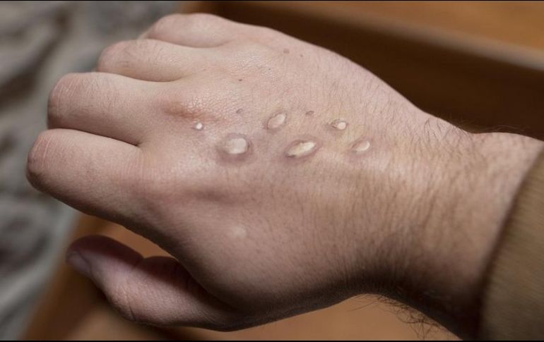 Debido al repunte de contagios a nivel nacional es necesaria la responsabilidad sanitaria por parte del gobierno. EL INFORMADOR/ Archivo