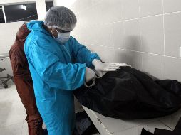 La víctima mortal por el virus del mono fue un hombre de 41 años. SUN/ARCHIVO