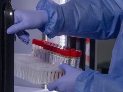 En Jalisco suman 28 casos de viruela del mono. Es la segunda entidad con más casos después de la Ciudad de México. ARCHIVO/ XINHUA