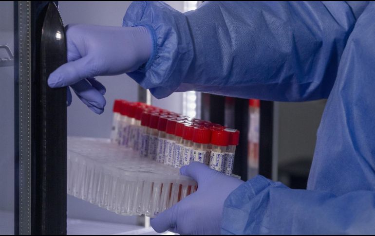 En Jalisco suman 28 casos de viruela del mono. Es la segunda entidad con más casos después de la Ciudad de México. ARCHIVO/ XINHUA