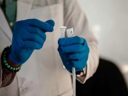 El masculino, quien se registra como el primer caso de viruela del simio en San Luis Potosí , ya se encuentra bajo cuidados médicos y aislado en su casa. EL INFORMADOR/ARCHIVO