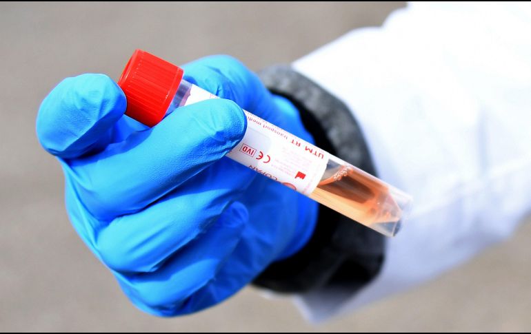 En Jalisco suman 33 casos; el primero se registró el 7 de junio de 2022. ARCHIVO/ AFP