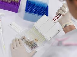 Las personas con viruela símica son infecciosas mientras tienen síntomas (normalmente entre dos y cuatro semanas). AFP / ARCHIVO