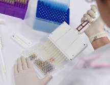 Las personas con viruela símica son infecciosas mientras tienen síntomas (normalmente entre dos y cuatro semanas). AFP / ARCHIVO