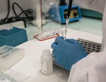 Hace falta realizar más pruebas contra la viruela del mono en México para detectar los casos a tiempo. AFP/ Archivo