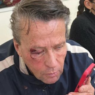 Alfredo Adame: ¿Y ahora? El actor recibe golpiza cerca de su casa, en Tlalpan