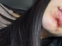 Fans de Kenia le han mandado mensajes de apoyo tras conocer el accidente. ESPECIAL