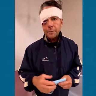 Alfredo Adame asegura que su ojo podría quedar inservible