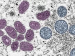 En Jalisco se han registrado 242 casos de viruela del mono. ESPECIAL