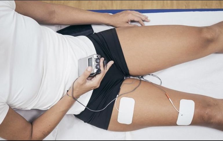 Los sistemas de electroestimulación muscular se han utilizado durante mucho tiempo para aliviar el dolor o para aumentar la movilidad. GETTY IMAGES