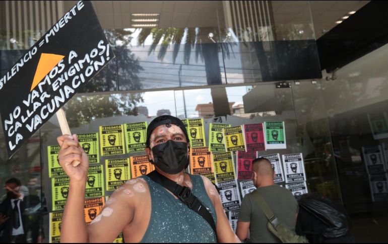 Del total de casos confirmados, el 98 % corresponde a hombres y el 2 % a mujeres. SUN/ ARCHIVO