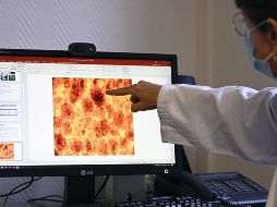 La OMS busca que las naciones de esa región en África tengan más recursos para combatir la enfermedad. AFP/ F. Florin