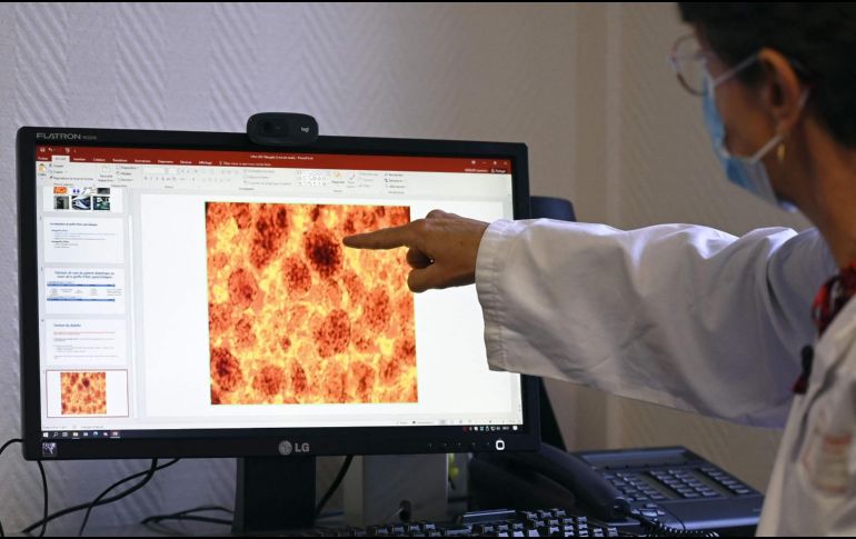 La OMS busca que las naciones de esa región en África tengan más recursos para combatir la enfermedad. AFP/ F. Florin