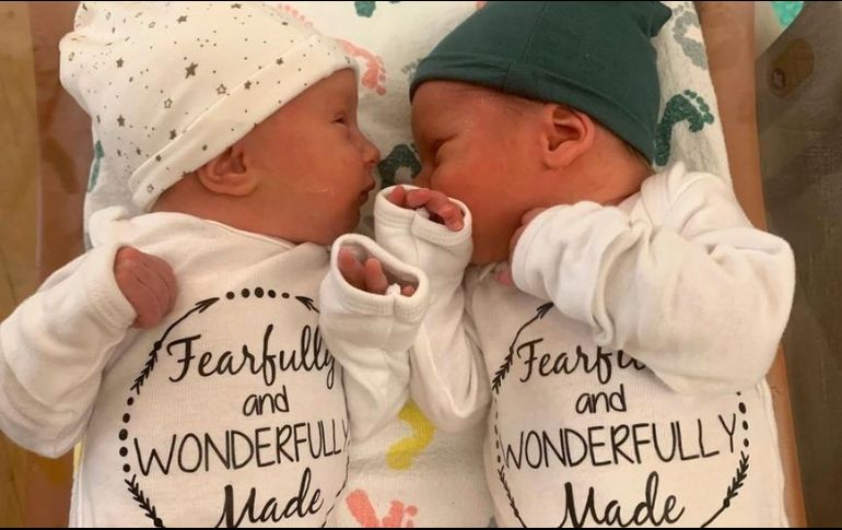 Lydia Ann y Timothy Ronald Ridgeway nacieron el 31 de octubre de 2022. EPA