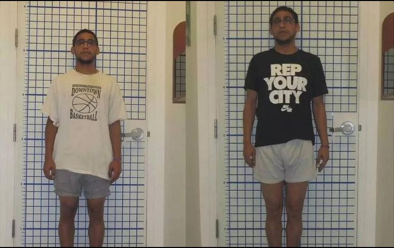 Sam se sometió a una operación que le ayudó a ganar unos centímetros. DR S. ROBERT ROZBRUCH