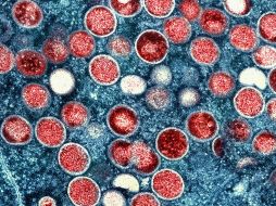 Argentina reportó 895 casos confirmados de mpox este lunes. AP/ARCHIVO