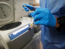 Cabe destacar que la Unidad de VIH trabaja en nuevas investigaciones como el protocolo de la vacuna contra VIH 