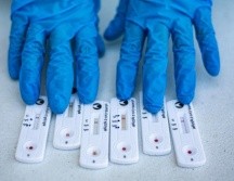 Los casos de COVID han tenido u alza en Jalisco debido al frío. EL INFORMADOR/ ARCHIVO