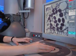 La Ciudad de México es la entidad que tiene más casos confirmados de viruela símica, con mil 943 personas contagiadas. ESPECIAL/Foto de CDC en Unsplash