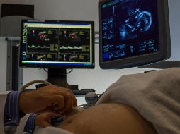 El Hospital Civil tiene un programa de Cirugía y Terapia Fetal. ARCHIVO
