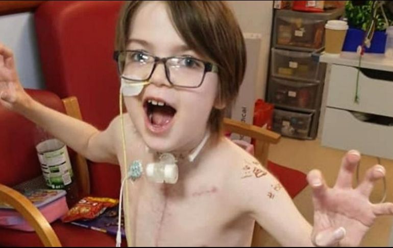 Kori, fotografiado aquí después de su segundo trasplante, es un fanático de la saga 