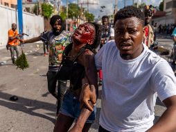 La inmigración se da por el brote de cólera y la violencia pandillera en Haití. AFP/ARCHIVO