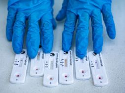 Después de Navidad y Año Nuevo, debido al contacto con multitudes los contagios de COVID se reanudaron y Uruguay presenta más de 5 mil casos en la primera semana de enero. EL INFORMADOR/ARCHIVO