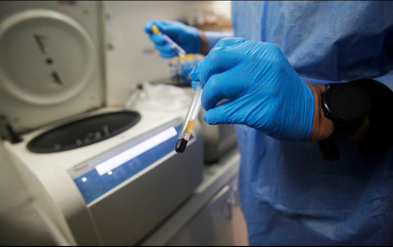 Si bien la vacuna contra el VIH no obtuvo los resultados esperados, será útil para futuras investigaciones. EFE/ ARCHIVO