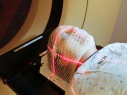 Brain fog: ¿Qué es la niebla mental y cómo combatirla? UNSPLASH/National Cancer Institute