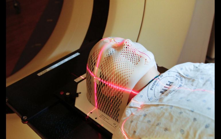 Brain fog: ¿Qué es la niebla mental y cómo combatirla? UNSPLASH/National Cancer Institute