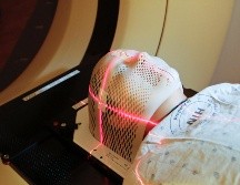 Brain fog: ¿Qué es la niebla mental y cómo combatirla? UNSPLASH/National Cancer Institute