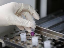 Desde la confirmación del primer caso el 28 de mayo de 2022, y hasta el 6 de febrero de 2023, se han identificado seis mil 385 personas que cumplen la definición operacional de caso probable. AFP / ARCHIVO