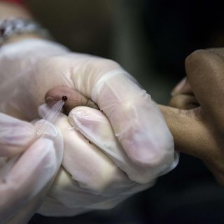 "Doy esperanza tras dos sentencias de muerte": paciente curado de VIH