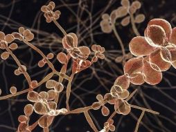 Los hongos del género Sporothrix, que se encuentran en el suelo y en algunas plantas ayudan a descomponer la materia orgánica en la naturaleza. GETTY IMAGES